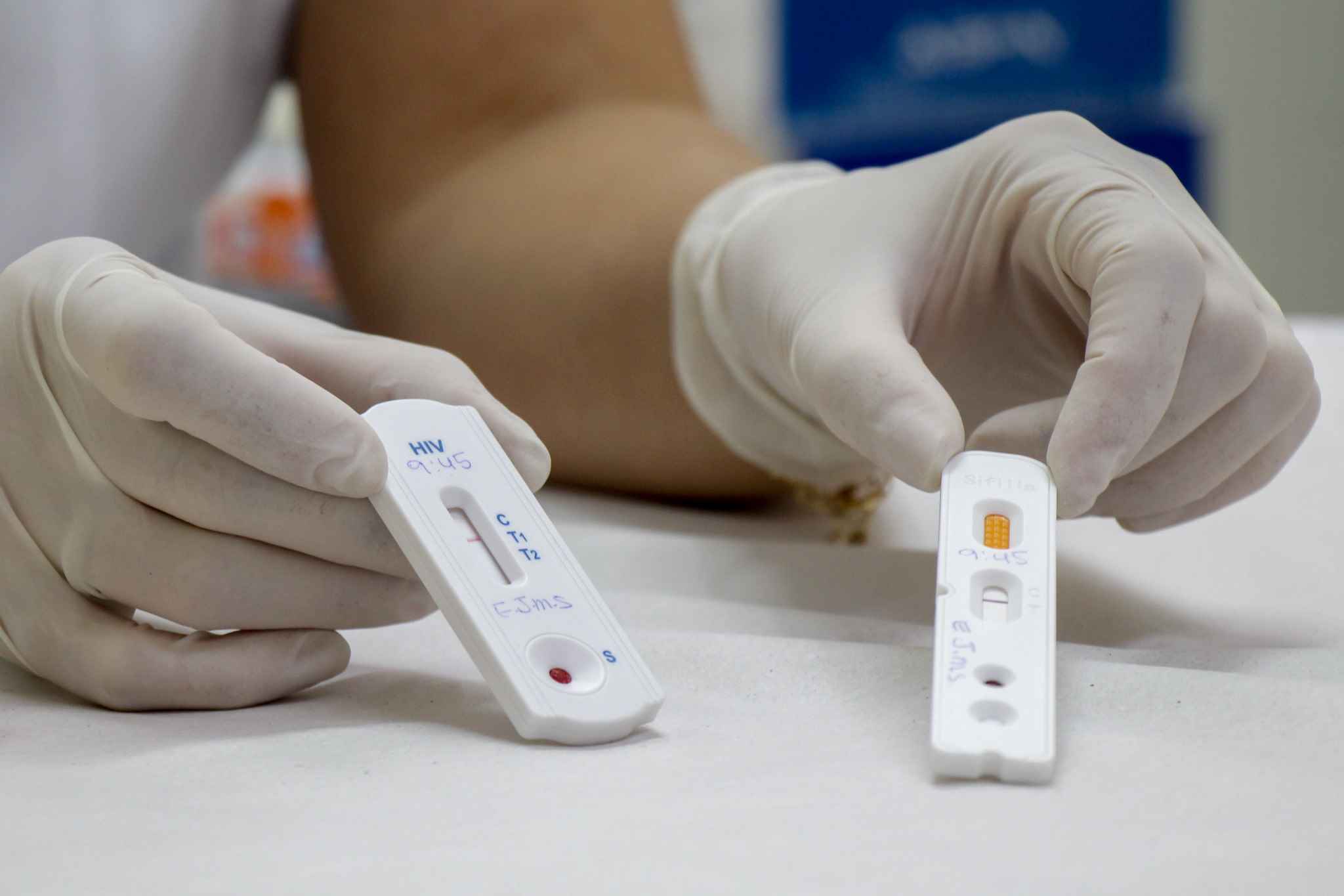 Ilhabela – Campanha Fique Sabendo para testagem rápida de HIV e Sífilis
